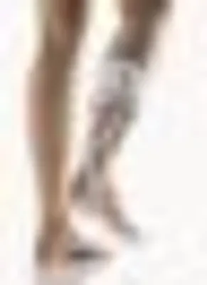 A close-up view of two legs, one with a patterned brace or support.