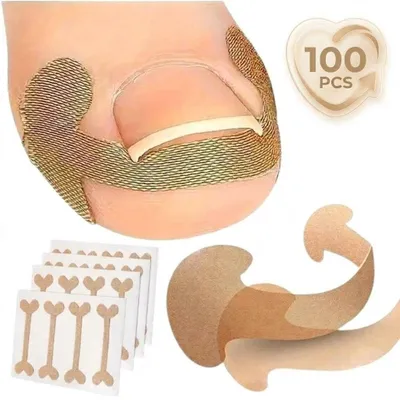 Rovnátko na nehet, domácí péče o nehty, 100 kusů - NailCorrect