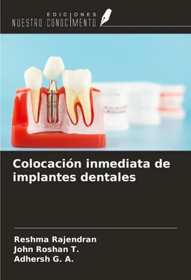 Produktbild von Colocación inmediata de implantes dentales