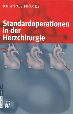 Produktbild von Standardoperationen in der Herzchirurgie