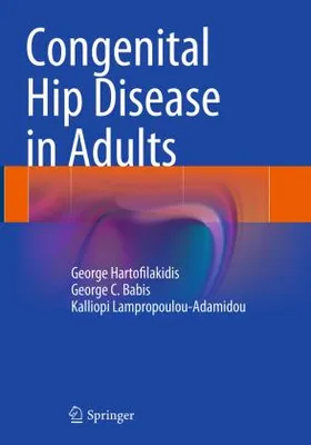 Produktbild von Congenital Hip Disease in Adults
