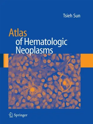 Produktbild von Atlas of Hematologic Neoplasms