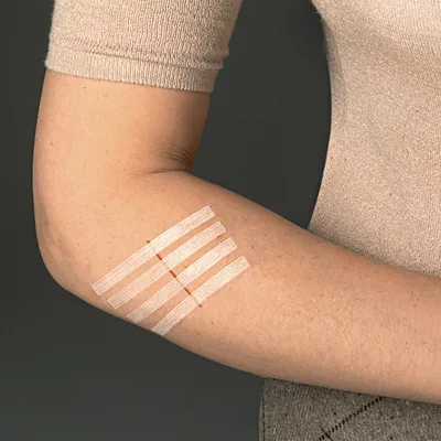 Obrázek produktu pro 3M Steri-Strip proužky pro uzavírání ran 6 x 75 mm (12 x 3 proužky)