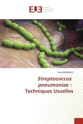 Produktbild von Streptococcus pneumoniae : Techniques Usuelles