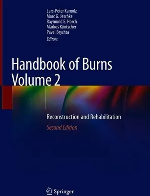 Produktbild von Handbook of Burns Volume 2