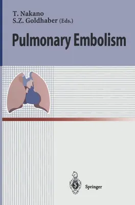 Image de Pulmonary Embolism