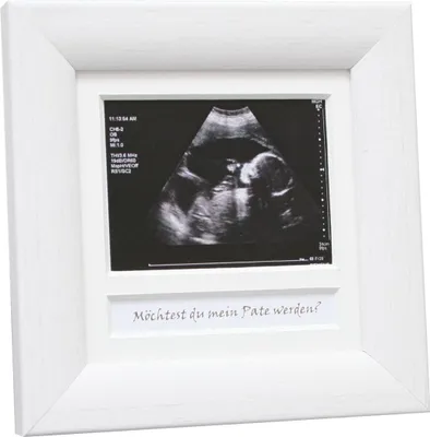 Produktbild von Deknudt Holz-Fotorahmen Echographie-Bild 10x10 cm weiß
