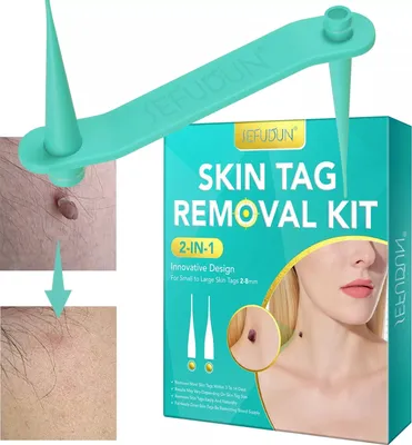 Produktbild von 2-in-1-Set zur schmerzlosen Entfernung von Hautanhängseln, 2-teiliger Stift zur Entfernung von Hautanhängseln, einfaches und schnell wirkendes Gerät zur Entfernung von Hautanhängseln von kleinen bis großen (1–9 mm) Hautanhängseln und Warzen an allen Körperteilen