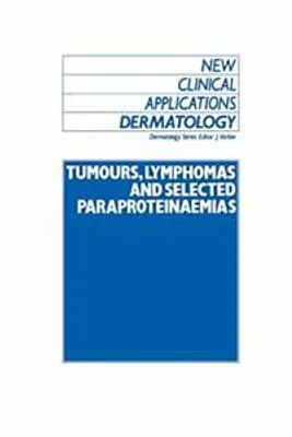 Produktbild von Tumours, Lymphomas and Selected Paraproteinaemias