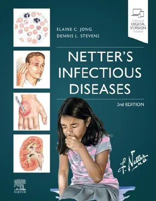 Produktbild von Netter's Infectious Diseases