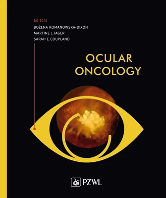 Zdjęcie produktu dla Ocular oncology