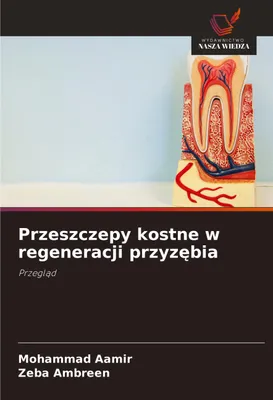 Produktbild von Przeszczepy kostne w regeneracji przyz¿bia