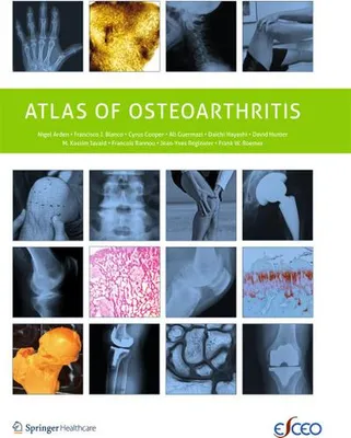 Obrázok produktu pre Atlas of Osteoarthritis