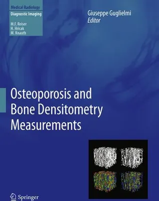Obrázek produktu pro Osteoporosis and Bone Densitometry Measurements