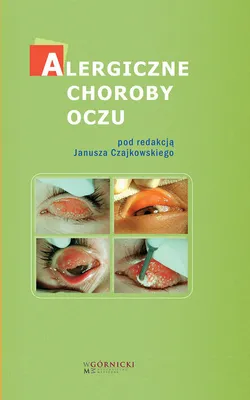 Obrázek produktu pro Alergiczne choroby oczu (Buch auf Polnisch)