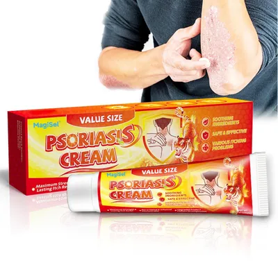 Immagine prodotto di Crema lenitiva antiprurito, per alleviare il prurito e il psoriasis