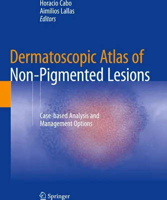 Produktbild von Dermatoscopic Atlas of Non-Pigmented Lesions