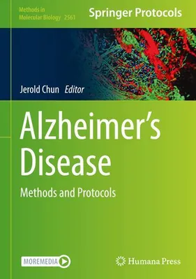 Obrázek produktu pro Alzheimer's Disease