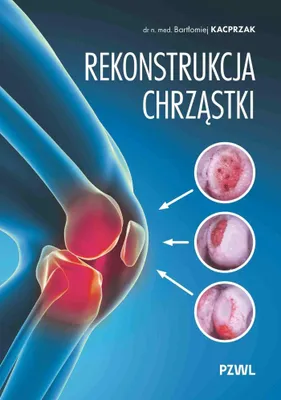 Immagine prodotto di Ricostruzione della cartilagine - Bartłomiej Kacprzak