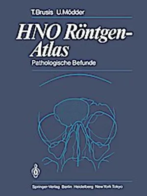 Immagine prodotto di HNO Röntgen-Atlas