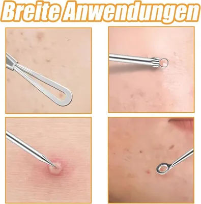 Porenreiniger, Hauptbild