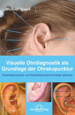 Produktbild von Visuelle Ohrdiagnostik als Grundlage der Ohrakupunktur