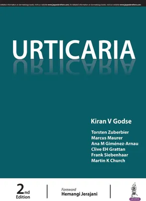 Produktbild von Urticaria
