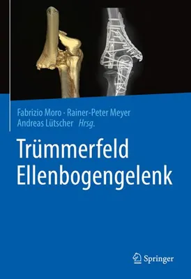 Image de Trümmerfeld Ellenbogengelenk