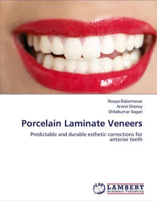 Produktbild von Porcelain Laminate Veneers