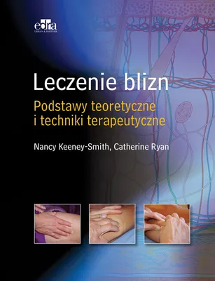 Immagine prodotto di Leczenie blizn pourazowych