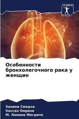 Produktbild von Osobennosti bronholegochnogo raka u zhenschin