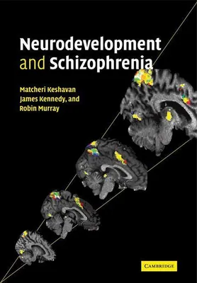Produktbild von Neurodevelopment and Schizophrenia