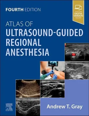 Obrázok produktu pre Atlas of Ultrasound-Guided Regional Anesthesia