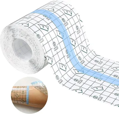 Laterne, Ansicht 2 von 7
