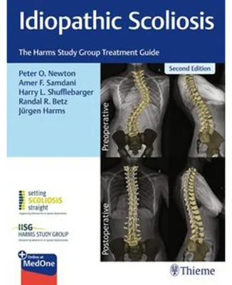 Produktbild von Idiopathic Scoliosis