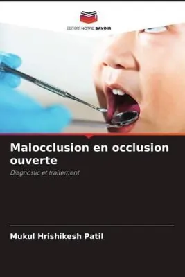 Produktbild von Malocclusion en occlusion ouverte