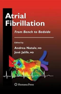 Image de Fibrillation auriculaire