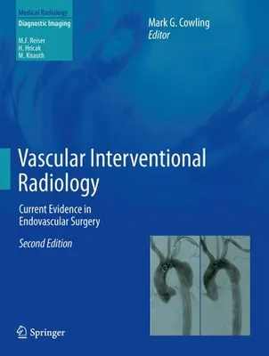 Image de Vascular Interventional Radiology