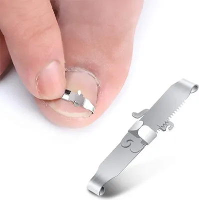 Produktbild von 2-teiliges Werkzeug für eingewachsene Nägel, Nagelkorrektur-Clips und -Heber für Paronychie, chirurgischer Edelstahl (Größe: EU 37-40)