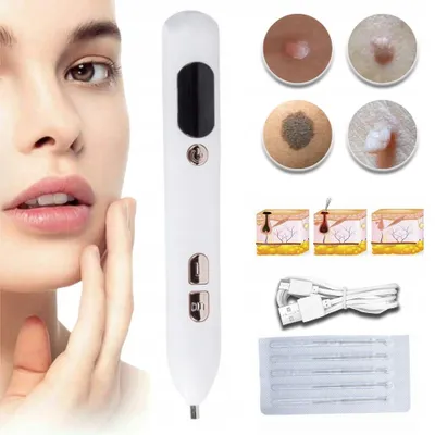 Zdjęcie produktu dla Plasma Laser Spot Removal Pen | do usuwania brodawek, pieprzyków, włókniaków | 9 poziomów mocy | zasilanie akumulatorowe