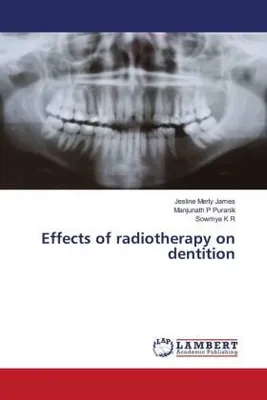 Produktbild von Effects of radiotherapy on dentition