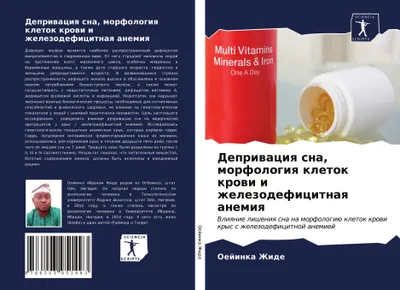 Produktbild von Depriwaciq sna, morfologiq kletok krowi i zhelezodeficitnaq anemiq
