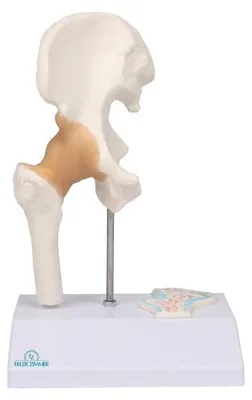 Immagine prodotto di Modello in miniatura dell'articolazione dell'anca con sezione trasversale