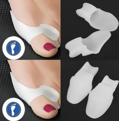 Produktbild von 2 Silikon Hallux Valgus Zehenspreizer