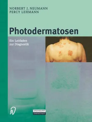 Image de Photodermatosen