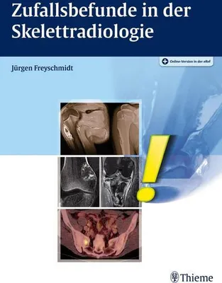 Produktbild von Zufallsbefunde in der Skelettradiologie
