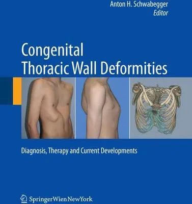 Obrázek produktu pro Congenital Thoracic Wall Deformities
