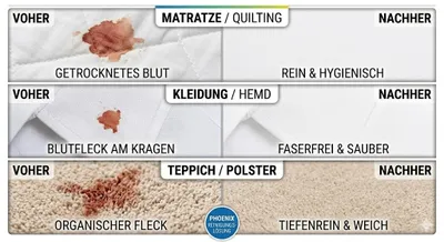 Produktbild von Blutflecken Entferner 200g (10L) Enzymreiniger + Drucksprüher 1L Set Matratze Teppich gegen Blutflecken Geruch | PHOENIX