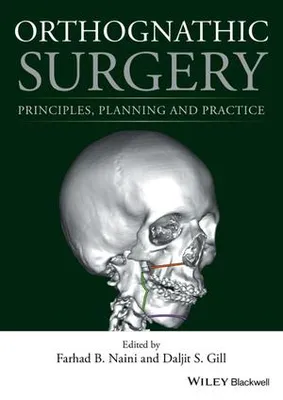 Obrázek produktu pro Orthognathic Surgery