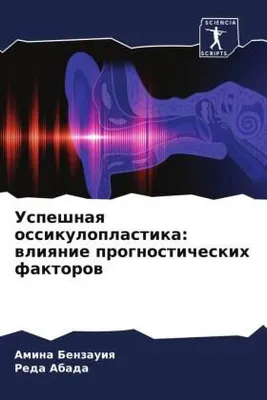 Produktbild von Uspeshnaq ossikuloplastika: wliqnie prognosticheskih faktorow